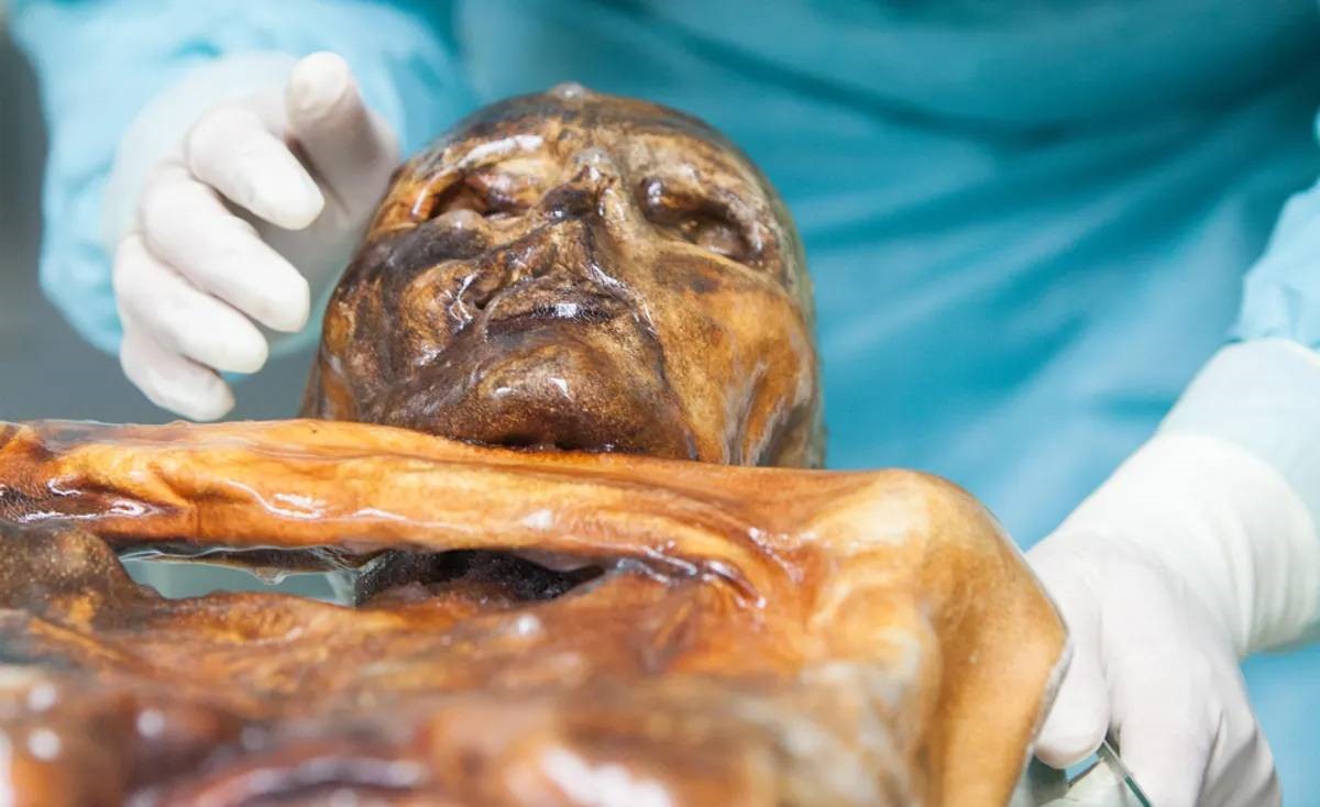 Buz Adam Ötzi'de aktif mikroplar bilim insanlarını şaşırttı