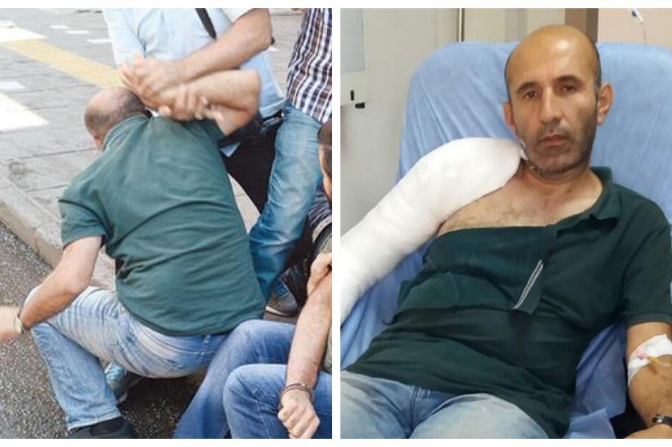 kol nasil kirilir