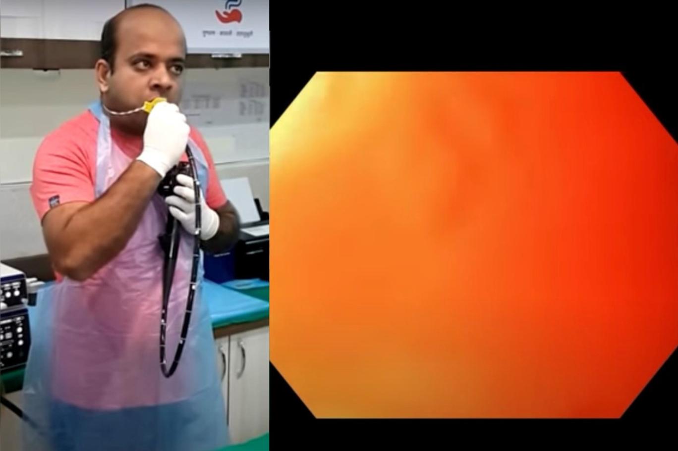 Kendi kendine endoskopi yapan Hintli doktor sosyal medyayı salladı