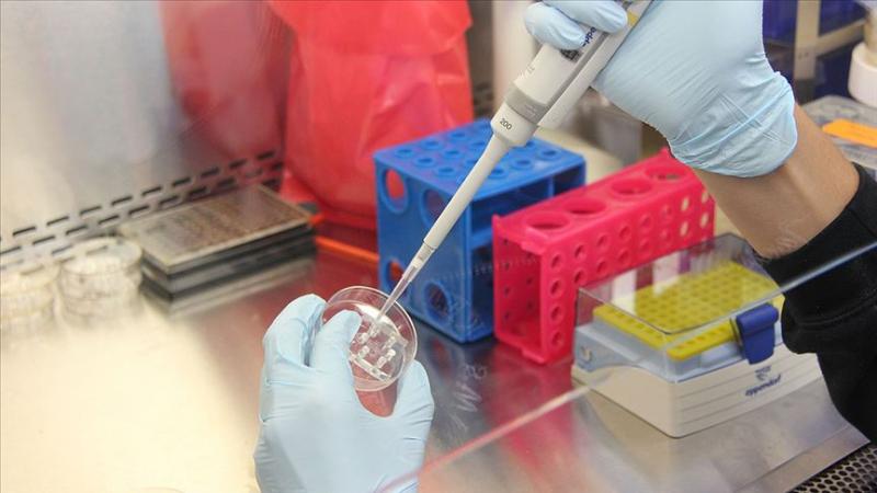 PCR testi koronavirüs AA.jpg