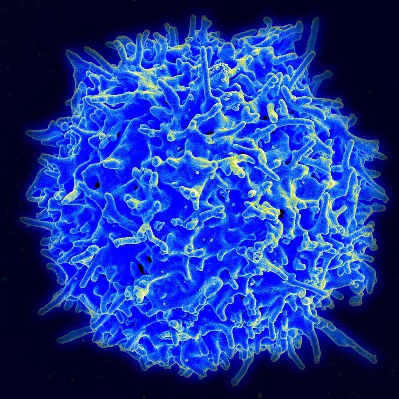 1024px-Healthy_Human_T_Cell.jpg