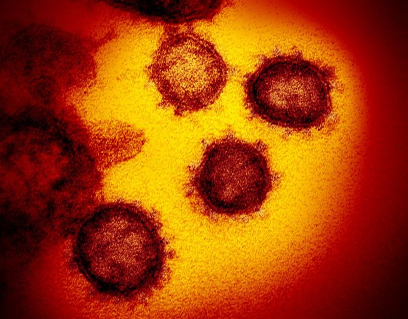 koronavirüs 1.jpg