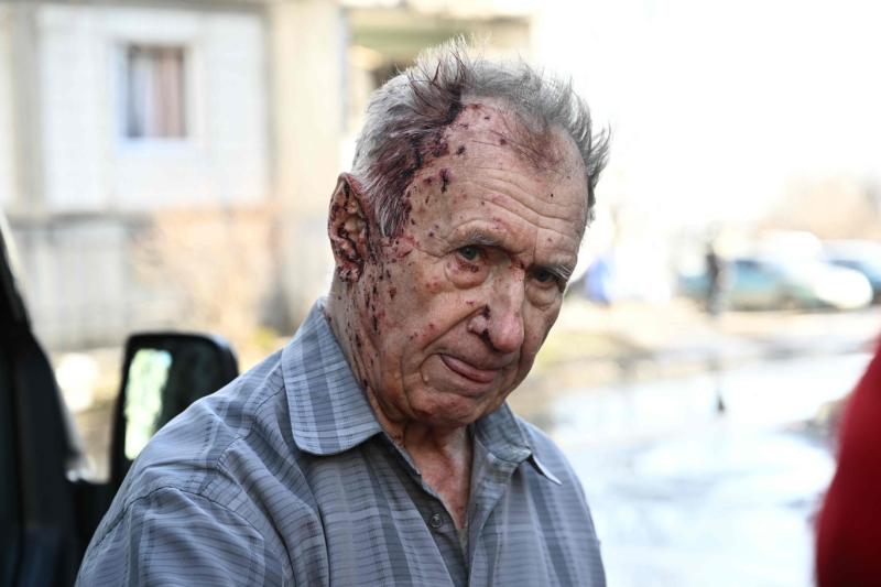 Chuguiv'de yaralanan yurttaş (AFP).jpg