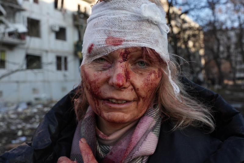 Kharkiv'de yaralanmış kadın (Anadolu Ajansı).jpg