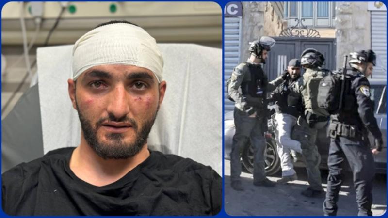 Doğu Kudüs'te aldığı darbeler sonucu hastaneye kaldırılan muhabir  Mustafa Haruf.jpg