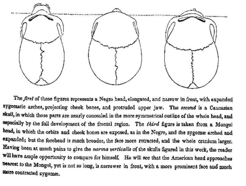 Görsel 5: Samuel George Morton (1839)