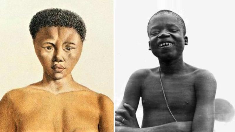 (Solda) Sarah Baartman (1789-1815) ile (sağda) Ota Benga (1883-1916)