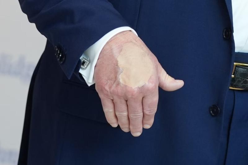 Donald Trump'ın eli (AP)