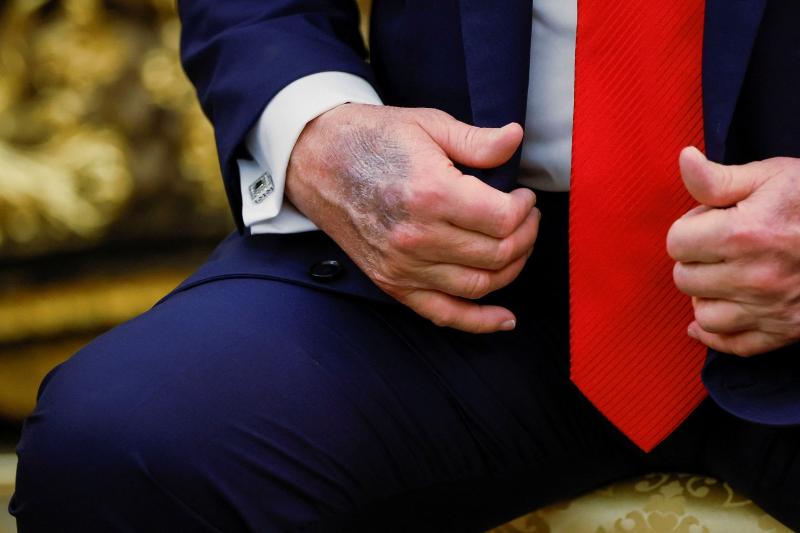 Trump'ın eli (Reuters)
