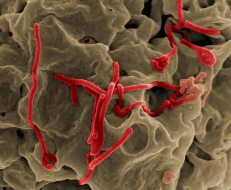 Ebola virüsü