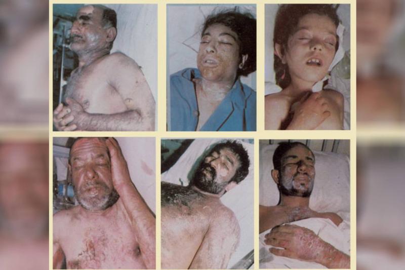 İran Serdeşt şehrinde Irak savaş uçaklarınca atılan kimyasal bombalardan etkilenenler, 1987    