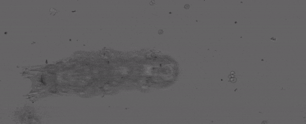 tardigrade-on-substrate-from-top.gif